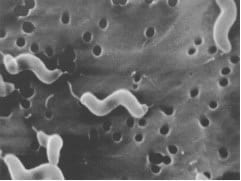 Contaminación microbiológica en los alimentos