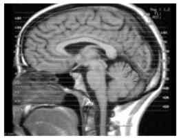 Una memoria grabada en el cerebro