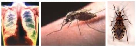 El número de enfermos de Tuberculosis, Malaria o Mal de Chagas aumenta en los países occidentales