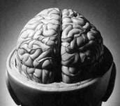 Asalto al Cerebro