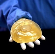 Uso, distribución y venta de implantes PIP fueron prohibidas desde 2010